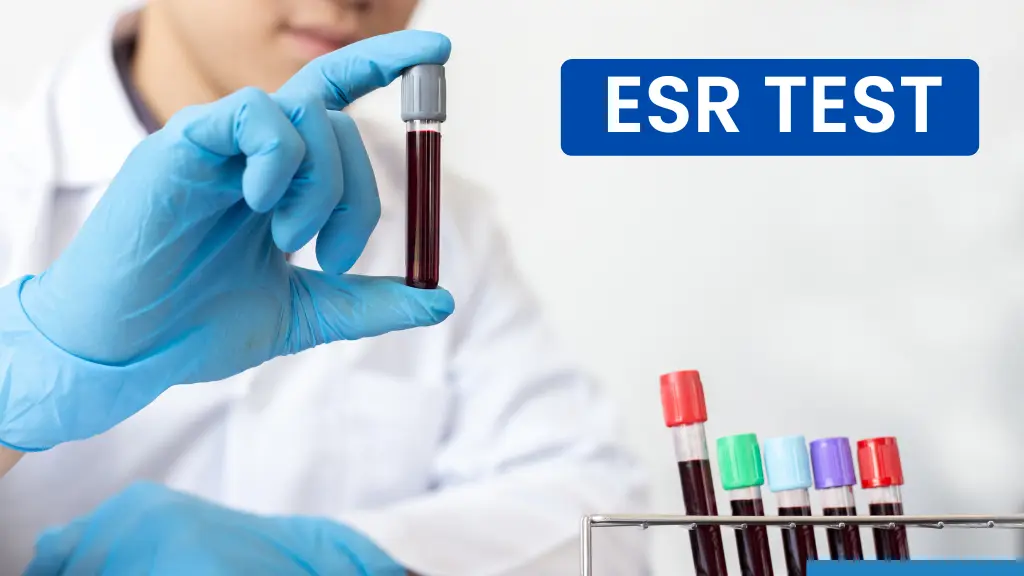 ESR Test in Hindi: इसकी मीनिंग, महिला और पुरुष में नॉर्मल रेंज - MyHealth